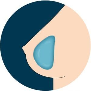 Understanding All Sex Doll Custom Featuresbreast gel implant 300x300 Understanding All Sex Doll Custom Featuresbreast gel implant 300x300